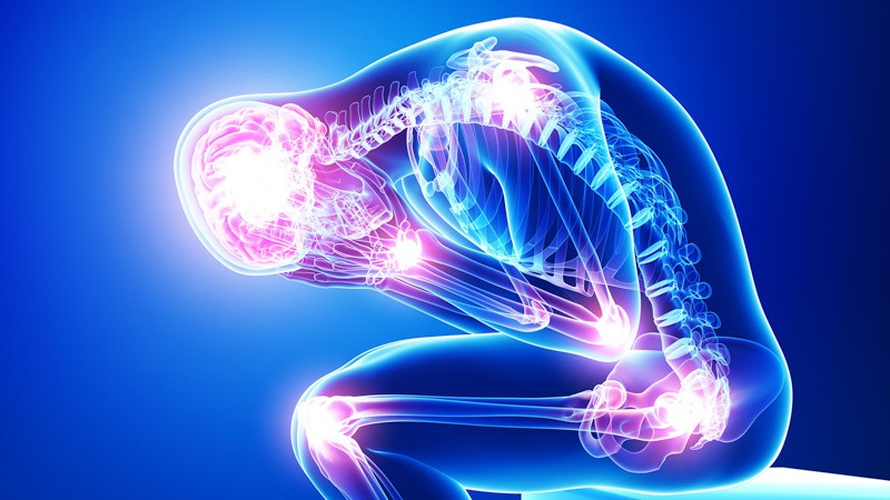 Skeletal Illustration of Person with Fibromyalgia Blue Background