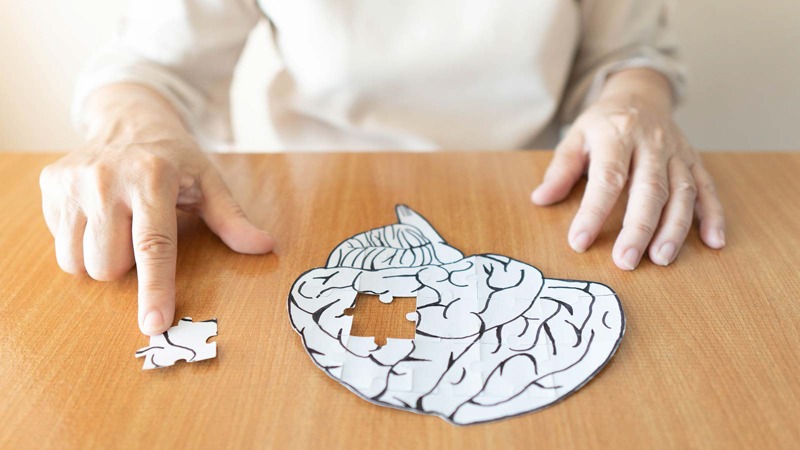 A Brain Puzzle Piece Taken from the Group- Sign of Dementia
